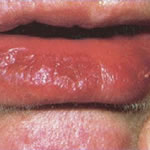 clinical pathology mouth
