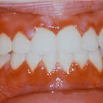 clinical pathology teeth