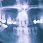 dental xray