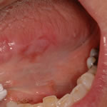 new patients