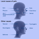 orofacial pain causes