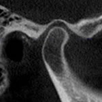 orofacial pain